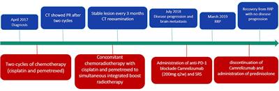Radiation Recall Pneumonitis Induced by Anti-PD-1 Blockade: A Case Report and Review of the Literature